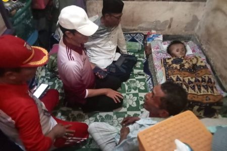 Wabup Pimpin Intervensi Terpadu, Anak Penderita Hidrosefalus di Kawo dapat Dukungan
